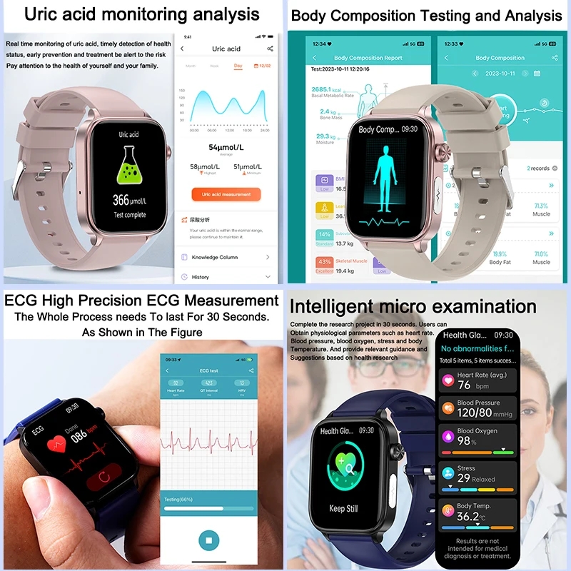 2025 New For XIAOM1 ECG+PPG Bl - đánh giá và giá Smartwatch New Watches 2025